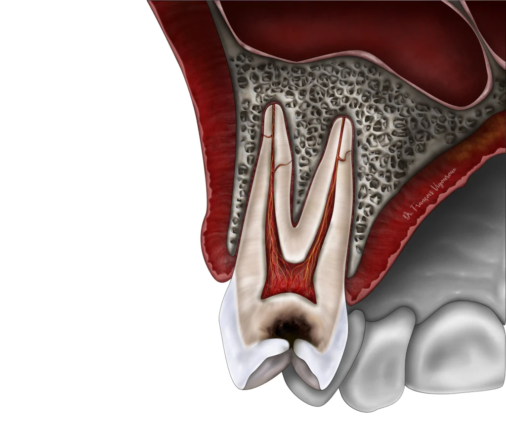 Les techniques de conservation de la vitalité pulpaire au Cabinet EndoSpé, endodontie exclusive à Paris 15ᵉ