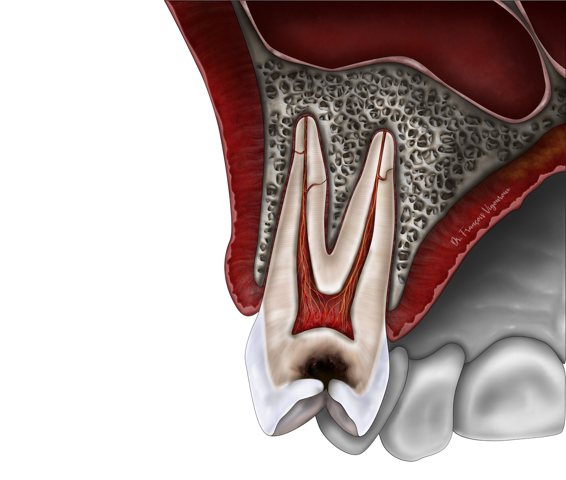 Les techniques de conservation de la vitalité pulpaire au Cabinet EndoSpé, endodontie exclusive à Paris 15ᵉ