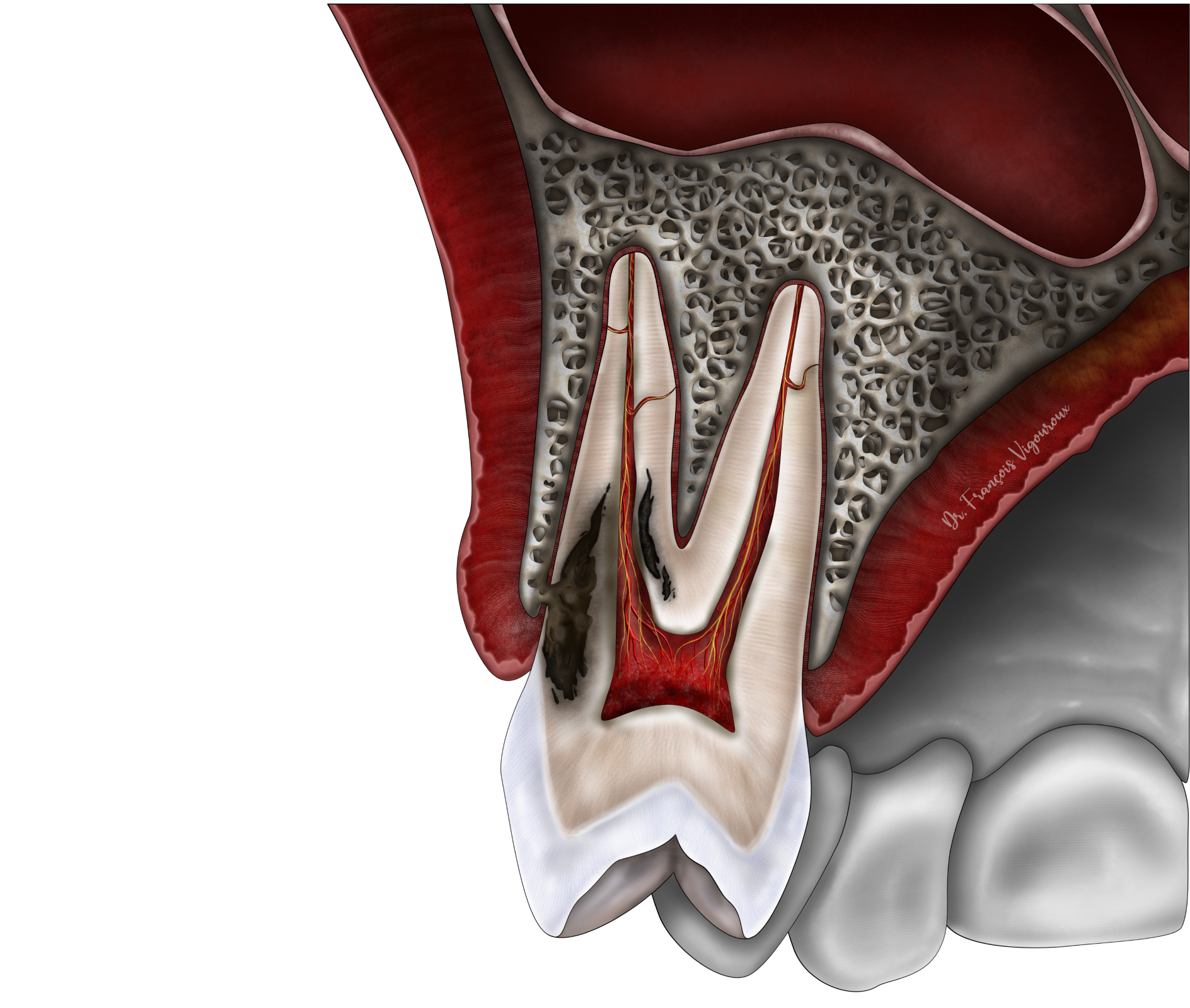Les techniques de conservation de la vitalité pulpaire au Cabinet EndoSpé, endodontie exclusive à Paris 15ᵉ
