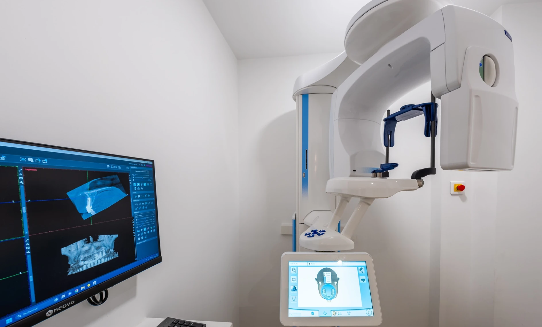 Les résorptions dentaires au Cabinet EndoSpé, endodontie exclusive à Paris 15ᵉ