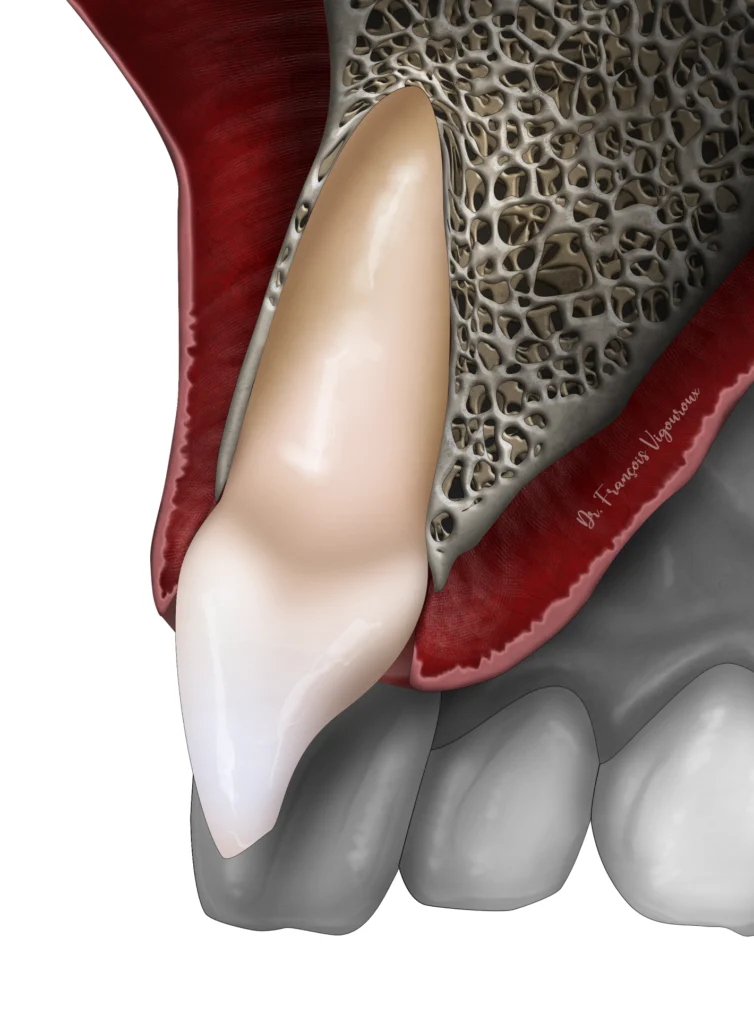  traumatisme dentaire